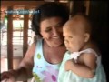 Maria Audete, la donna 30enne che sembra una bambina