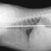 Elsie, una bimba di sei mesi ingoiò nel 2005 un coltello di 33 centimetri