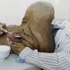 Huang Chuncai - L'uomo Elefante Cinese