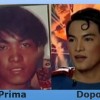 Ragazzo Filippino si sottopone a chirurgia plastica per somigliare a superman